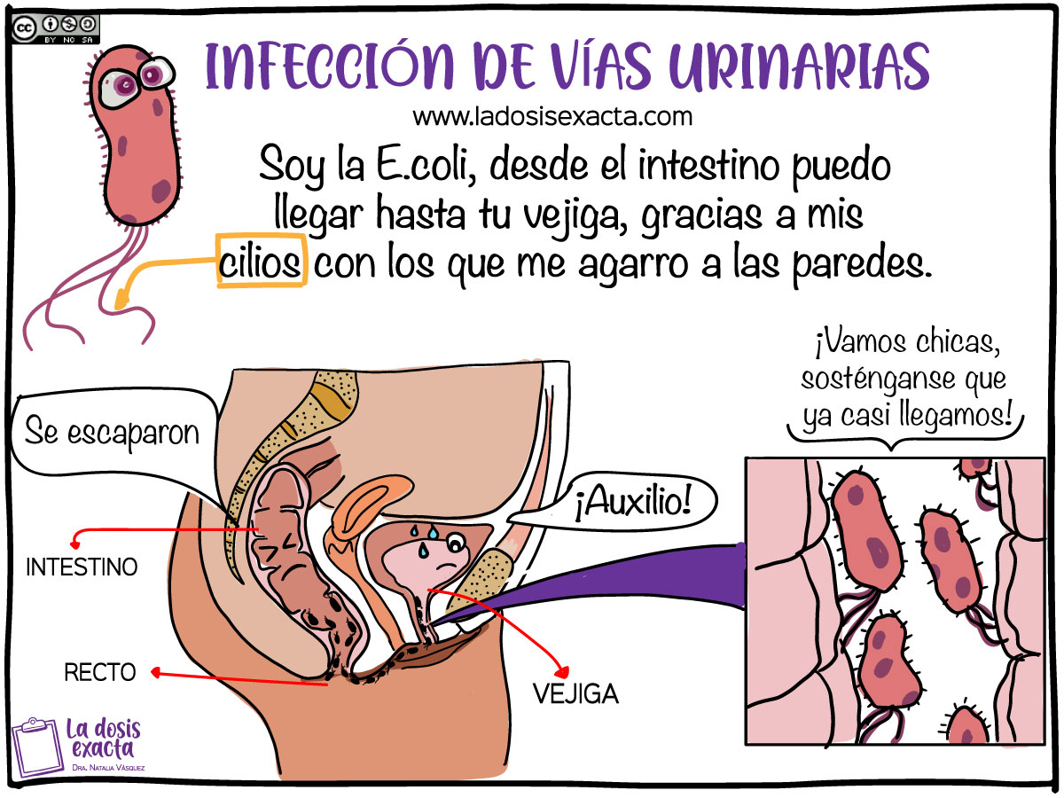 Infección Urinaria En La Mujer Síntomas Tratamiento Y Prevención ☆ Dra Natalia Vásquez